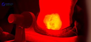 Can You Use Red Light Therapy While Pregnant