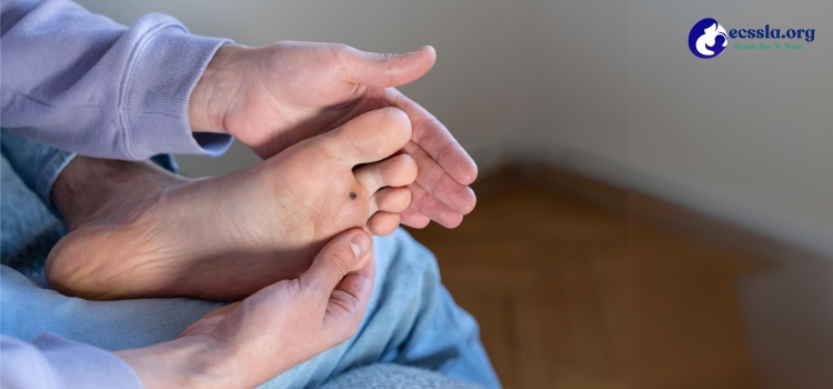 how to get rid of a foot callus