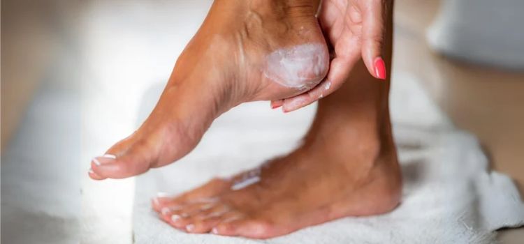 Best Foot Creams for Corns and Calluses